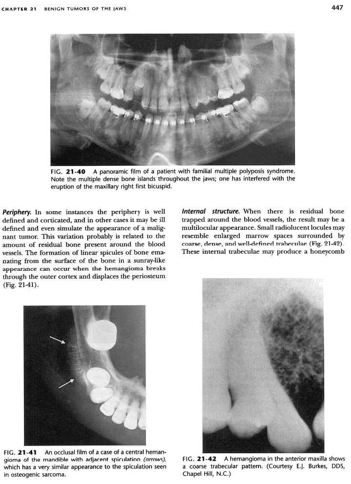 CHAPTER 21 BENIGN TUMORS OF THE JAWS 447 FIG. 21-40 A panoramic film of a patient with familial multiple polyposis syndrome.