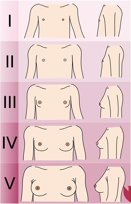 Hypothalamic pituitary adrenal axis Pubic hair Axillary hair Acne Body odor DHEAS 17OHP Testosterone Tanner Staging -Breasts Stage 1: No palpable breast tissue.