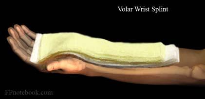 Upper Extremity Splints Volar Wrist