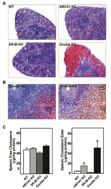 Role of macrophage ABCA1 and SR-BI in atherogenesis Massive foam cell formation in spleen and peritoneum by combined deletion of ABCA1 and SR-BI in bone marrow-derived cells To assess potential