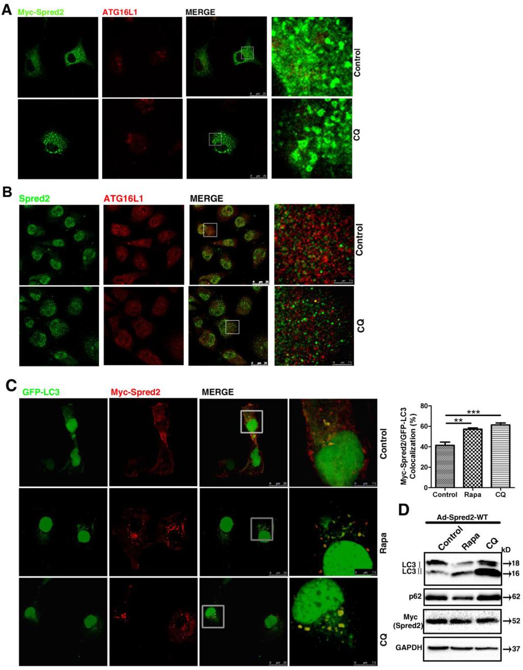 Supplementary Figure S2: Spred2 co-localizes with LC3. Cells were fixed and analyzed for co-localization by confocal microscopy.