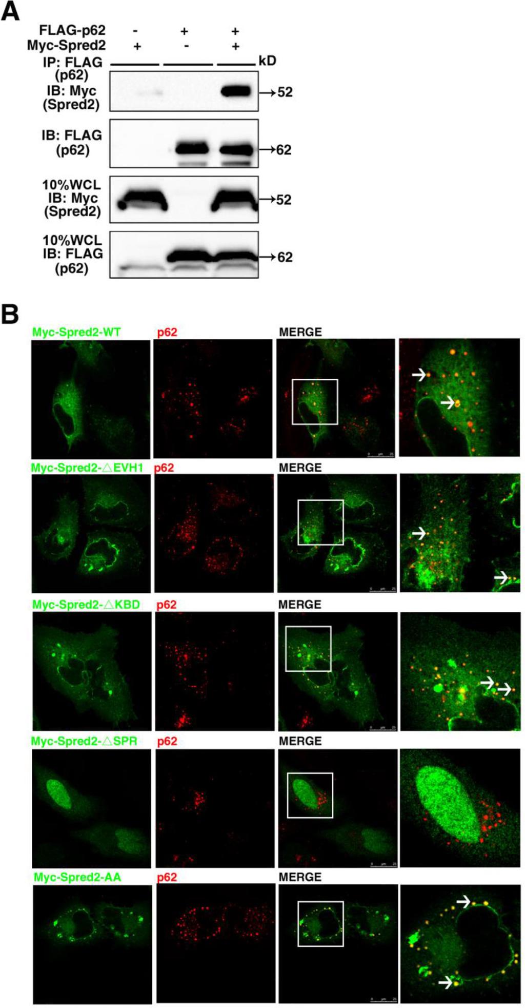 Supplementary Figure S3: Spred2 interacts and co-localizes with p62.