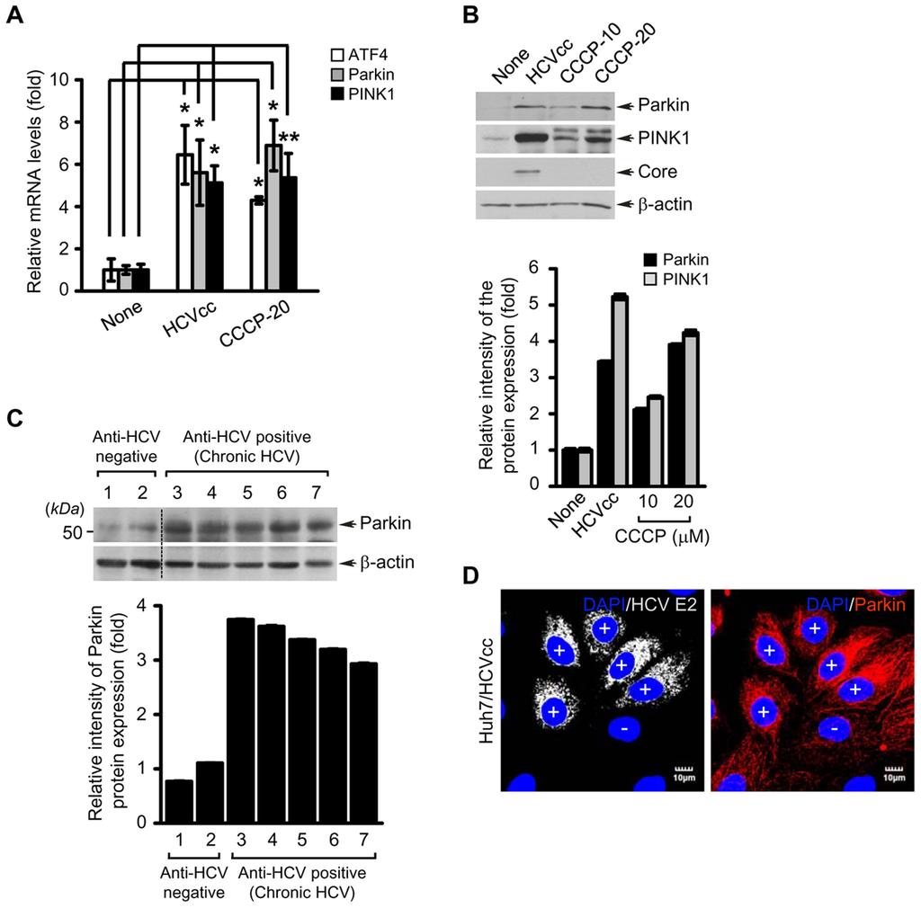 Figure 2. HCV infection induces the ubiquitination of Parkin and its mitochondrial substrates Mfn2 and VDAC1, and autophagyassociated factor p62.