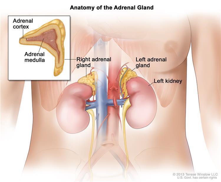 Addison s Disease Hyposecretion of Adrenal