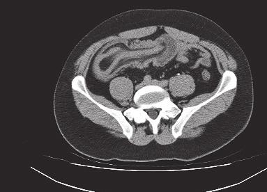 50) Figure 1 Computed tomography