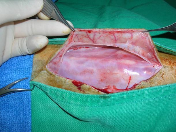 大範圍切除 傷口癒合的問題 ( 不癒合總比有腫瘤好 ) 61 62 Healing problem of 15 cases 8 cases accepted wide margin excision Re-excision and closure of the wound