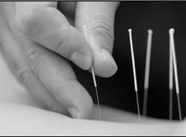 Acupuncture Significantly relieves pain Significantly