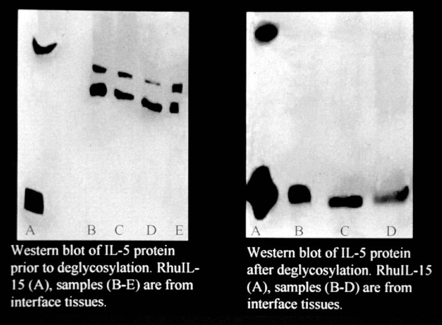 Western blot of IL15 protein prior to deglycosylation: A rhuil15, B-E interface