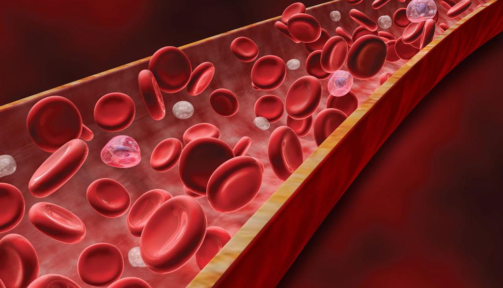 Haematological Multi-factorial causes of anaemia Direct effect of HIV on marrow Iron