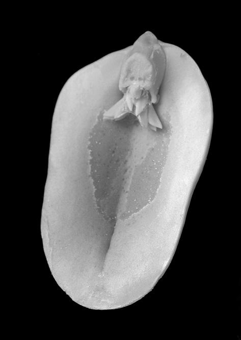 6 2 Vegetarian sources of protein, for example seeds and single cell proteins, are increasingly being used throughout the world. Fig. 2.1 shows the surface view of half of a peanut seed with the embryo attached.