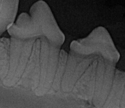 Dental Radiographs This is an x-ray of Healthy