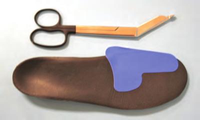 Figure 5: First ray PTFE Patch on right orthosis.