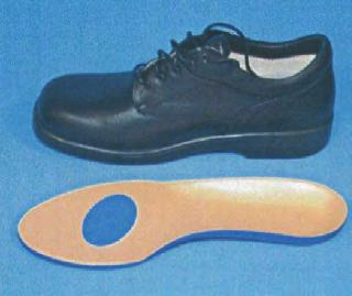 irritation in patients with adult acquired flatfoot and patients with accessory navicular To reduce posterior heel irritation and shoe wear place a PTFE patch to extend topcover life are in those