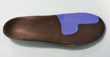 Figure 7: First ray PTFE Patch applied to right orthosis formation and ulcerations of the diabetic foot, shear forces also play a significant role.
