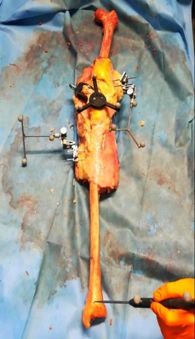 CHAPTER III Cadaver Test Fig. 3-26.