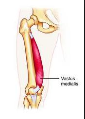 Vastus medialis Intertrochanteric line/linea aspera Quadriceps tendon to
