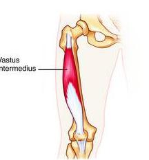 Vastus intermed ius Anterior/lateral femoral shaft Quadriceps tendon to patella Patella via quadriceps