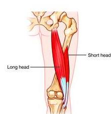Biceps femoris Ischial tuberosity & linea aspera and lateral supracondylar line of femur