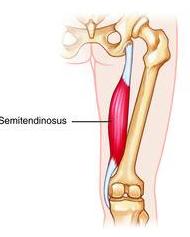 Extension of hip joint Sciatic Semitendinous Ischial tuberosity Medial surface superior