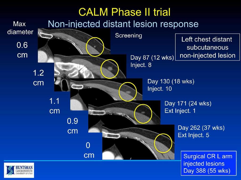 CAVATAK Phase 2 CALM Melanoma Study Presentation by Dr Robert Andtbacka (World Congress of Melanoma, July 18, 2013) Response in both injected and noninjected metastatic lesions Patient displayed a