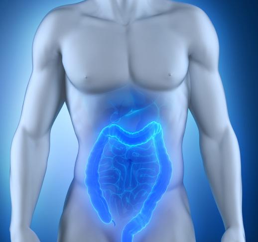 COLORECTAL CARCINOMA Colorectal cancer is one of the most frequent cancer diseases worldwide. The majority of cases arise at an advanced age and as a single case in a given family.