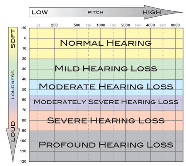 We perform the audiogram test in a silent room, we apply different frequencies to the patient for each ear, for example; we start with 1 khz and increase the frequency gradually, and we plot each