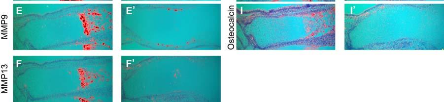 Delayed Progression of Chondrocyte Maturation in the Absence of β-catenin Function In situ hybridization with the indicated probes on consecutive sections of the developing ulna at 15.