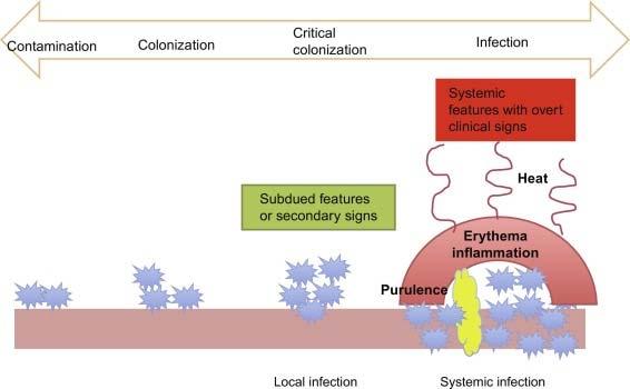 BACTERIAL LEVELS IN THE WOUND Contamination bacteria present on surface but no issues Colonization bacteria attach to tissue and multiply Infection