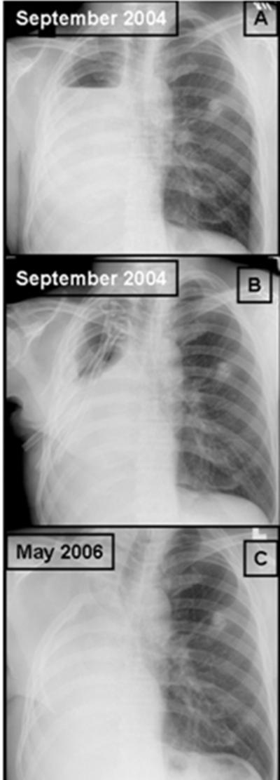 Figure 2 Figure 2: Picture of the patient showing