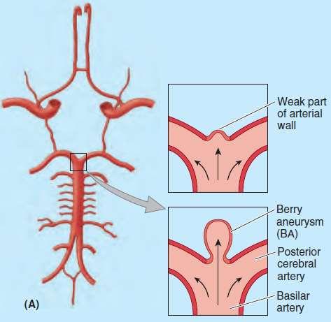 Basilar artery and major branches Formed by the union of the left and right vertebral arteries.