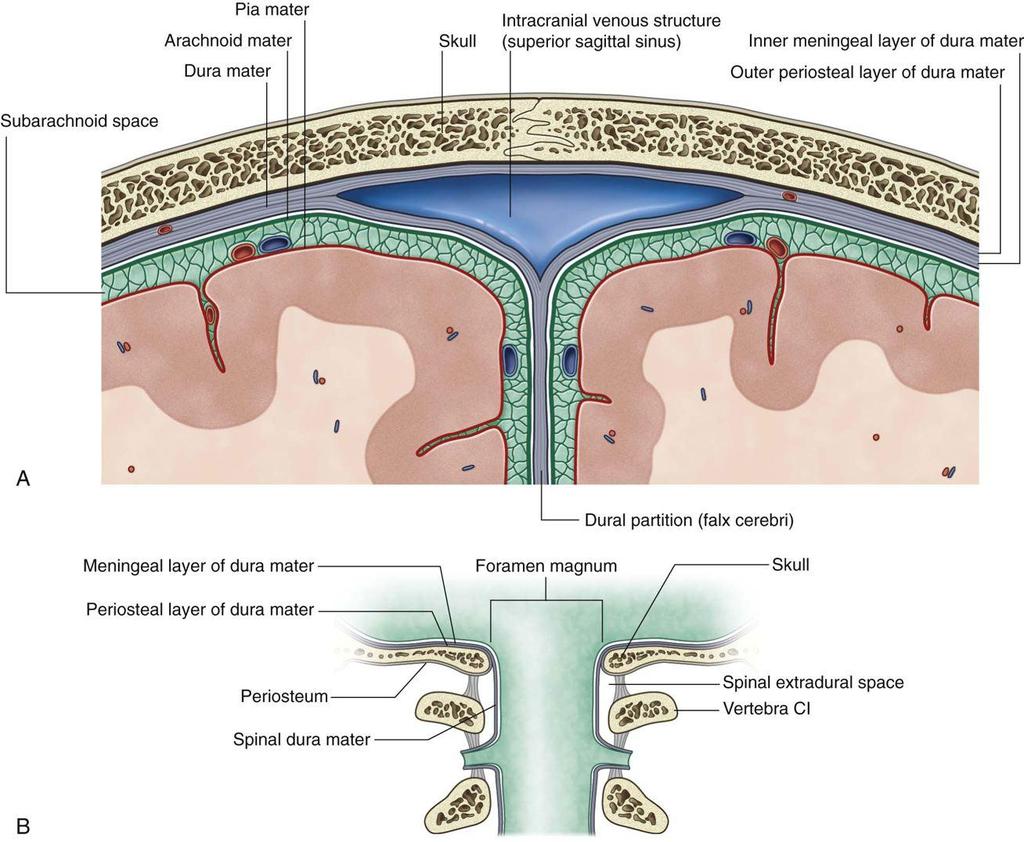 The Venous Blood Sinuses They are intracranial blood filled spaces Run between the layers of the dura mater or the dural fold They are lined by endothelium Their walls are thick and composed of