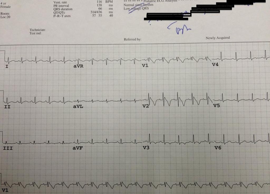 EKG of the week Nov 5th - Nov 9th 2012 Survey EKG of the week Nov 5th - Nov 9th 2012 EKG 7 12-11-07 1:43 AM 1. Before you begin the test, please identify yourself with one of the following groups 1.
