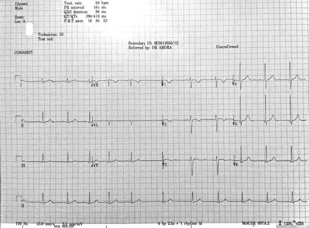 EKG Feb 4th 2013 EKG Question 10 1. Please start by choosing your appropriate affiliation from the list below. 1. CHEO 2. DGP McMaster 3. Sickkids 4.