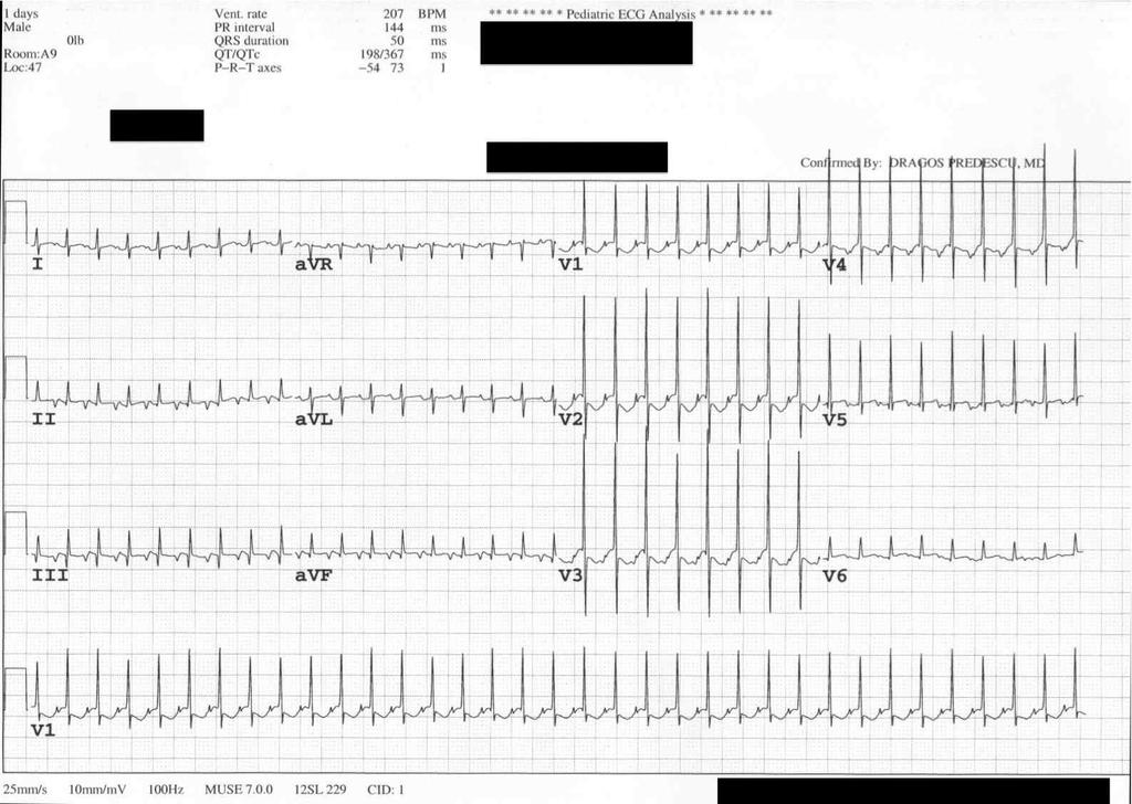 EKG of the week 8-12 Oct 2012 Survey EKG of the week 8-12 Oct 2012 EKG 4 12-10-10 10:14 PM This baby was brought directly from the delivery room to the NICU due to increased HR noticed immediately