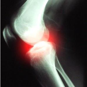 Articular Cartilage Injury Epidemiology 931
