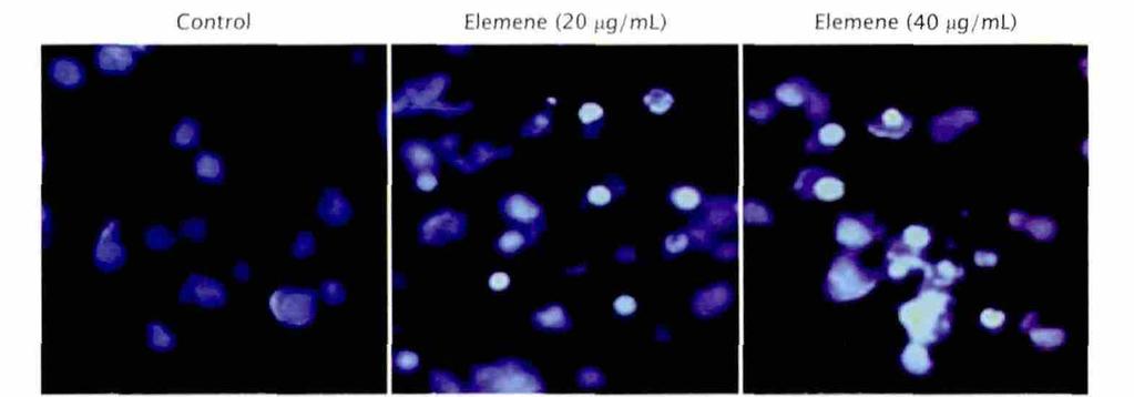 by Hoechst 33342, 4). Control: A549/ DDP cells treated without elemene. 3 2 4 μg/ml A549/DDP 24 h Hoechst 33342 4 Control Elemene (2 μg/ml) Elemene (4 μg/ml) 1 4.8 17.3 1 4.59 18.9 1 4 1.