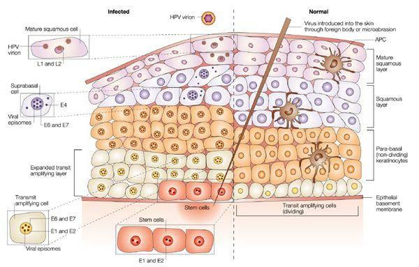Immunological processes in HPV infection HPV-infected cells become invisible