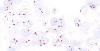 tissue validated by IHC using