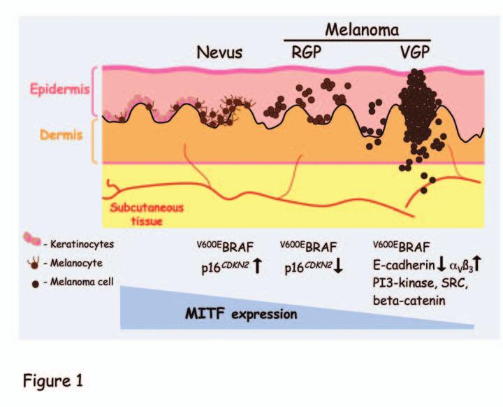 Tackling melanoma: new insights from combined approaches threonine kinase BRAF, which is mutationally activated in 50-70% of melanomas ( V600E BRAF), is also found mutated in up to 80% of benign nevi.