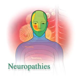 Neuropathic Pain It s BIG, it s Growing and it s Underdeveloped Neuropathic pain is one of the