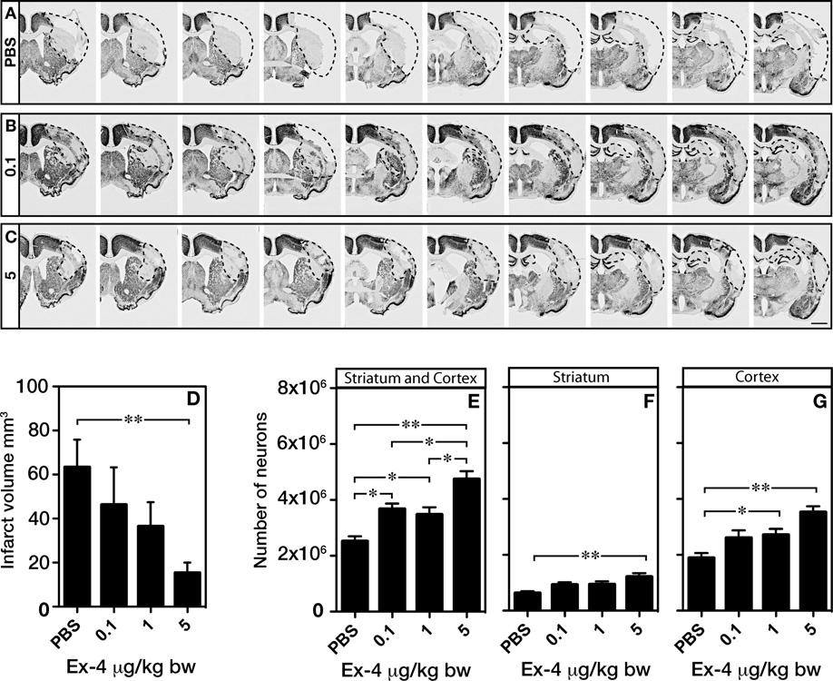 GLP-1R for the treatment of stroke in diabetes 477 Figure 4 Neuroprotective effect of Ex-4 (A C) Photomicrographs of representative ischaemic damage after treatment with PBS, or Ex-4 at 0.