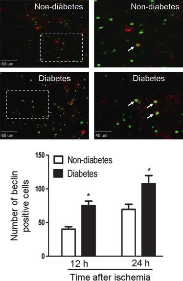 Autophagic Cell Death in Diabetic Stroke N. Wei et al.