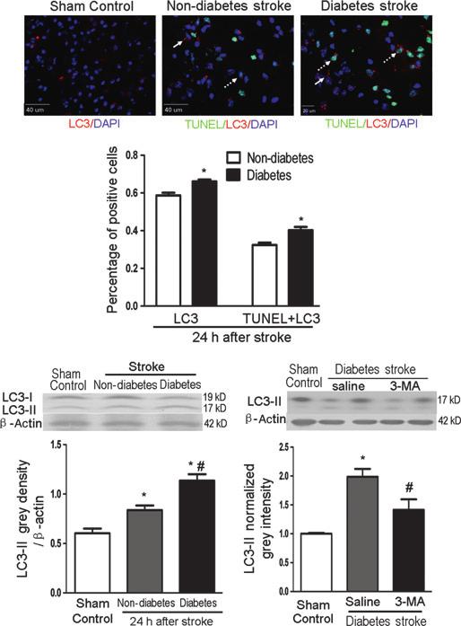N. Wei et al. Autophagic Cell Death in Diabetic Stroke (A) (B) (C) (D) (E) (F) Figure 2 Increased autophagic cell death in the diabetic stroke brain.