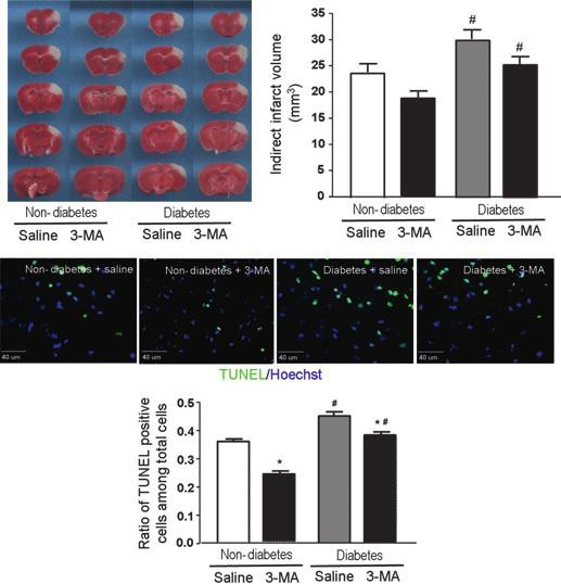N. Wei et al. Autophagic Cell Death in Diabetic Stroke (A) (B) (C) (D) (E) (F) (G) Figure 4 Protective effect of autophagy inhibition with 3-MA in the diabetic ischemic brain.