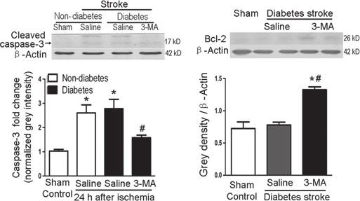 N. Wei et al. Autophagic Cell Death in Diabetic Stroke (A) (B) Figure 6 Effects of 3-MA on caspase-3 activation and the expression level of Bcl-2 in the diabetic stroke brain.