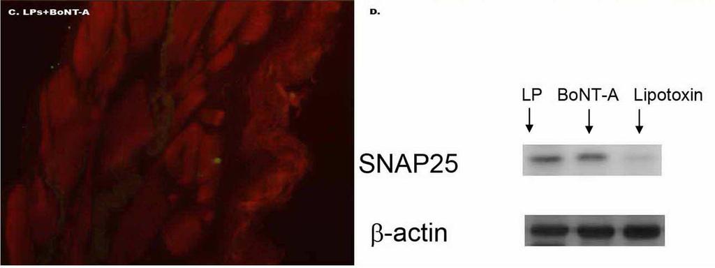 However, SNAP-25 positive neuronal fibers were rarely seen in the Lipotoxin  Western