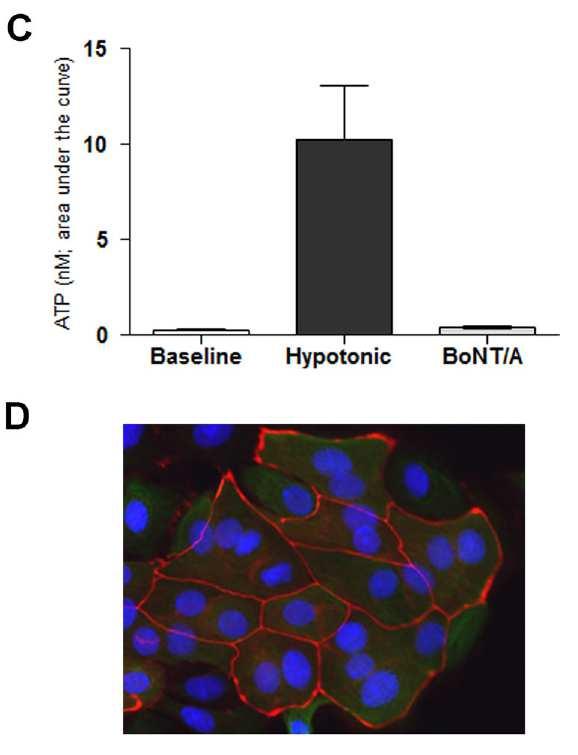 Effect of Botulinum Toxin A on Urothelial-Release of ATP and Expression of SNARE Targets Within the Urothelium (Hanna-Mitchell & Birder* et al.