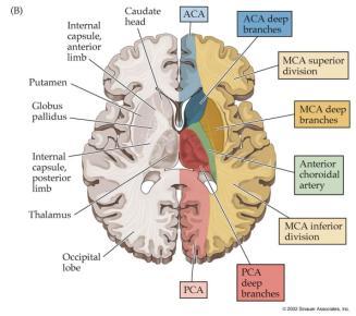 caudate Infarction results in prominent motor and neuropsychological