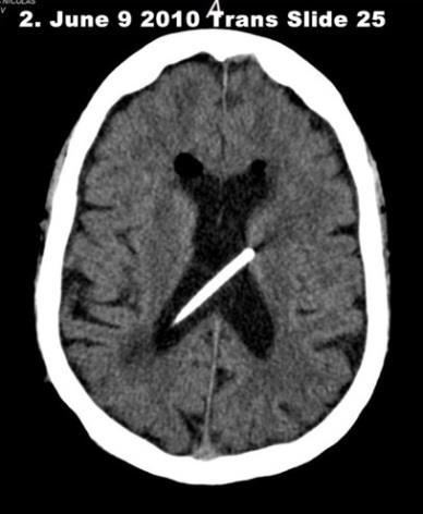 CT Brain Images On-Line Published Report