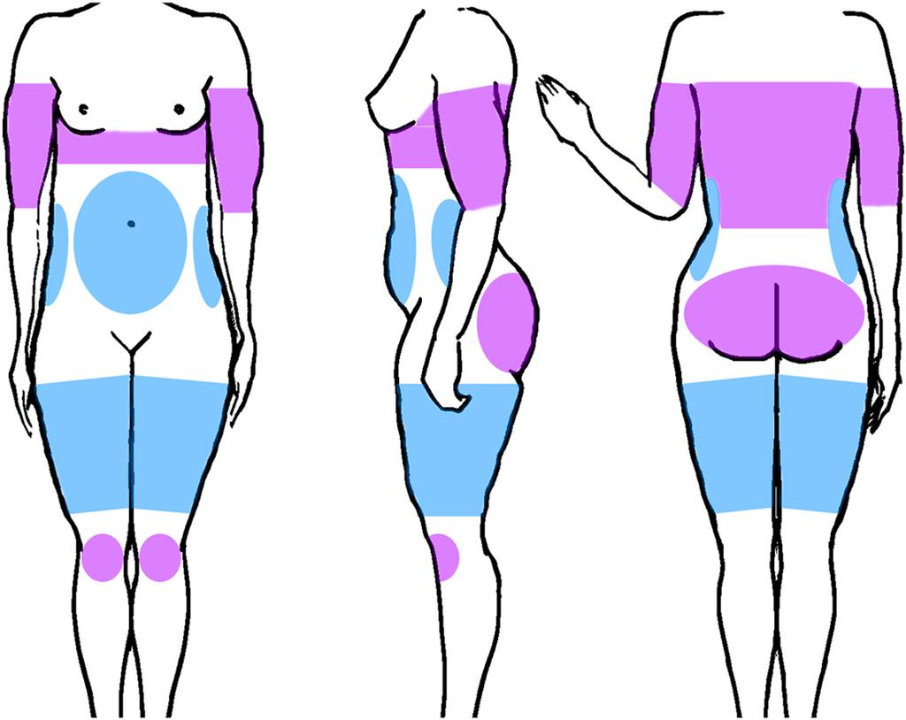 the FDA also cleared this system for the treatment of subcutaneous fat in the thighs (Figure 1).